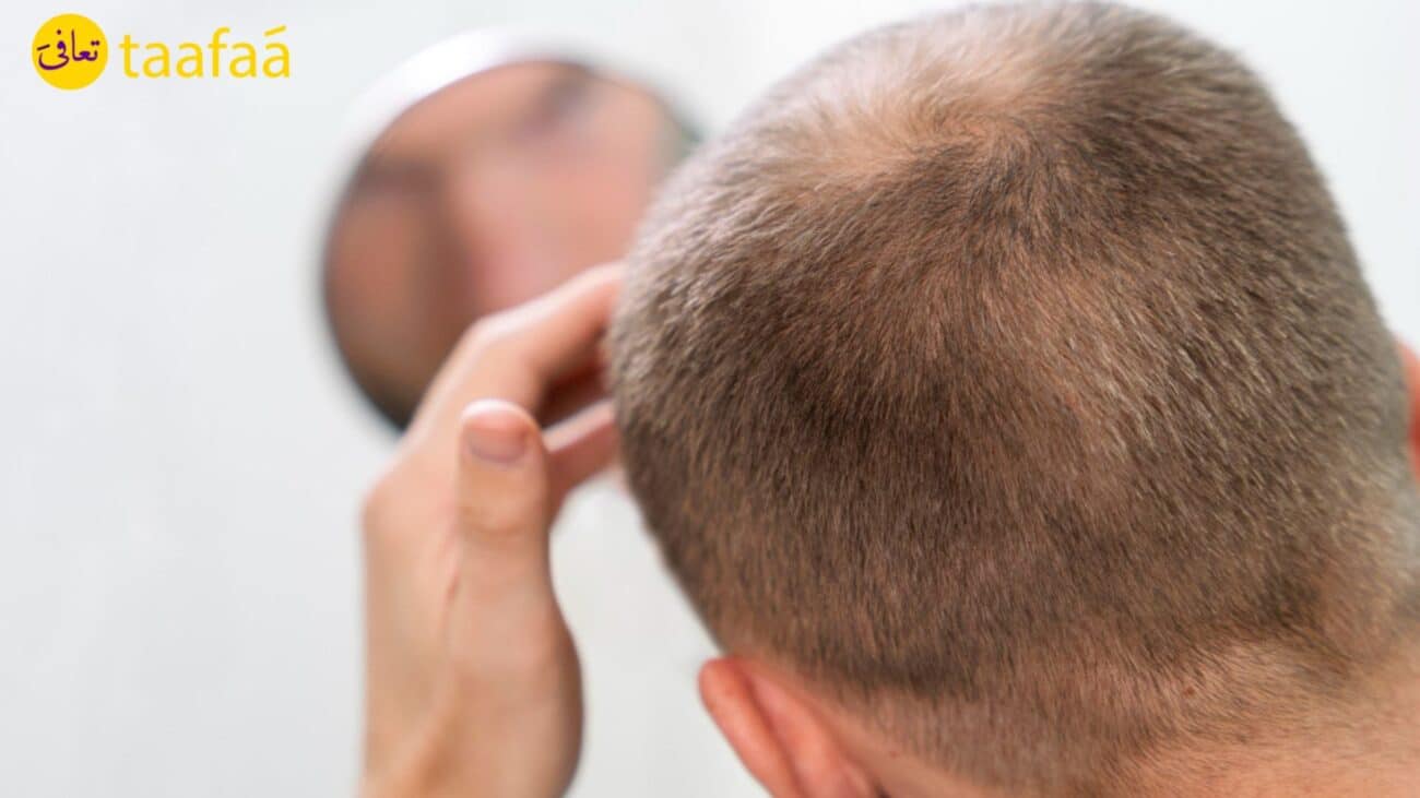 افضل عيادة لعلاج تساقط الشعر في مسقط